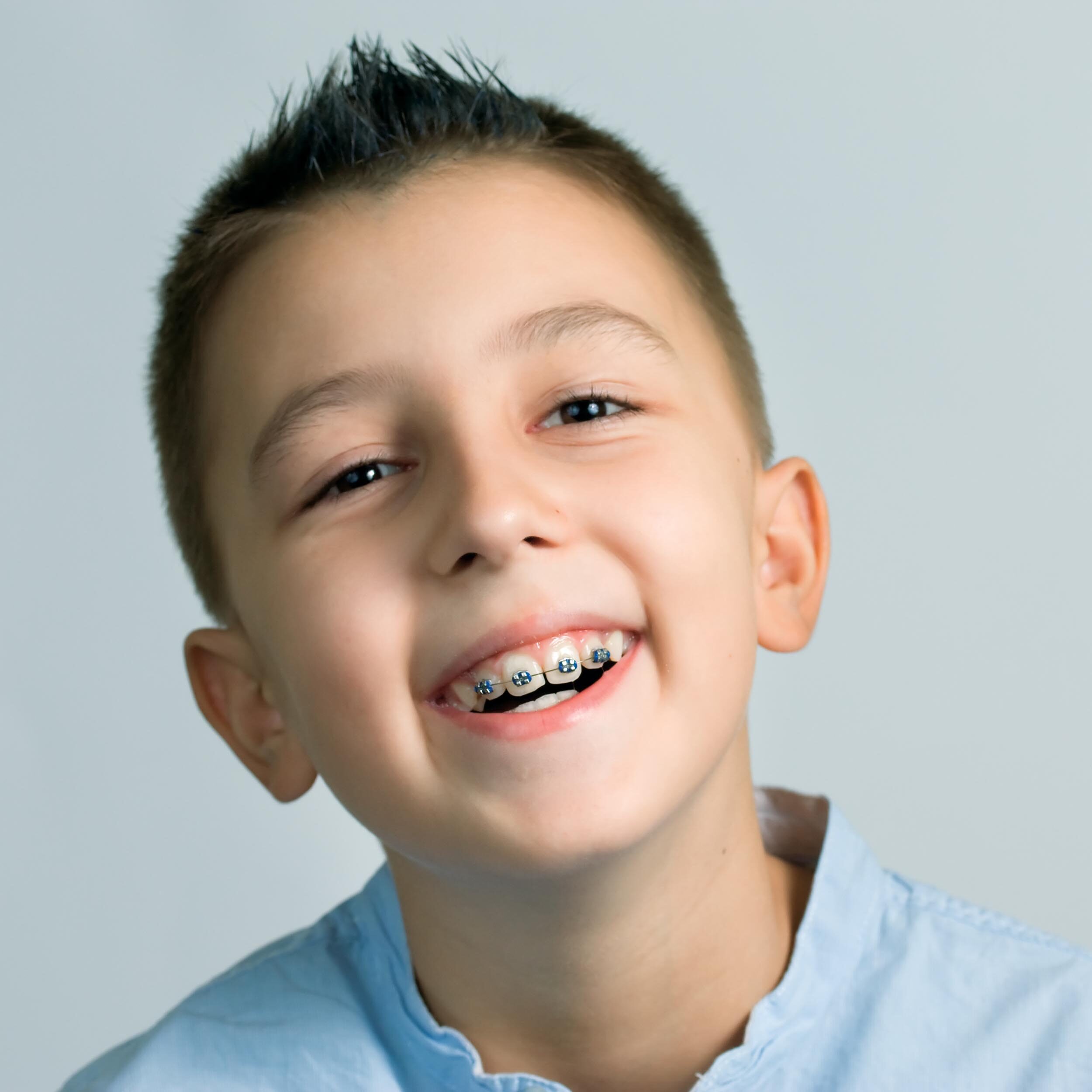 A smiling young boy showcasing his braces, a result of his orthodontic treatment.