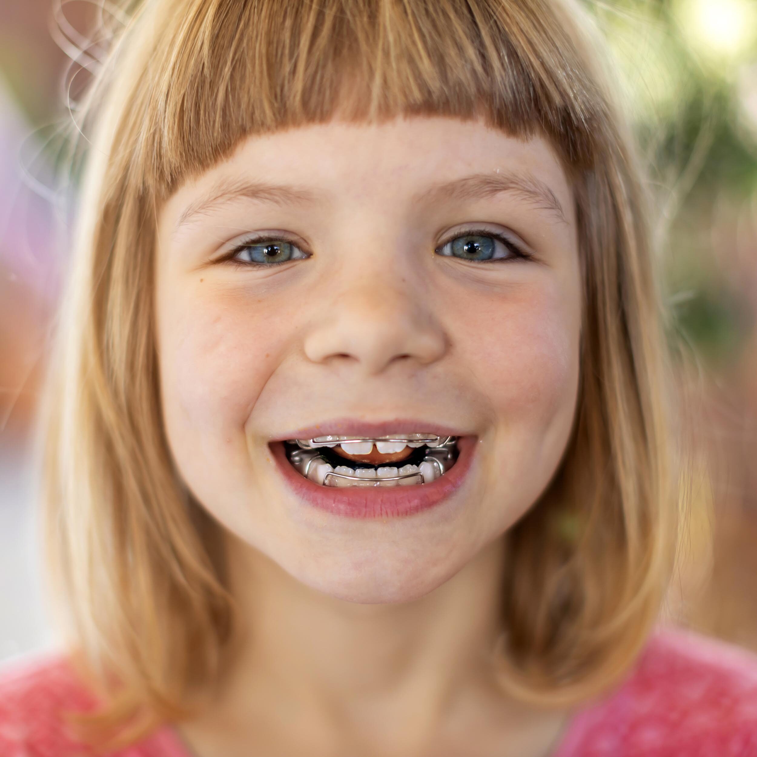 A smiling young girl with braces on her teeth, indicating successful orthodontic treatment.